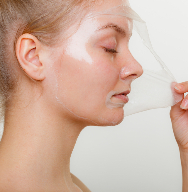 Beauty,Skin,Care,Cosmetics,And,Health,Concept.,Young,Woman,Face Résultats du peeling chimique pour le visage