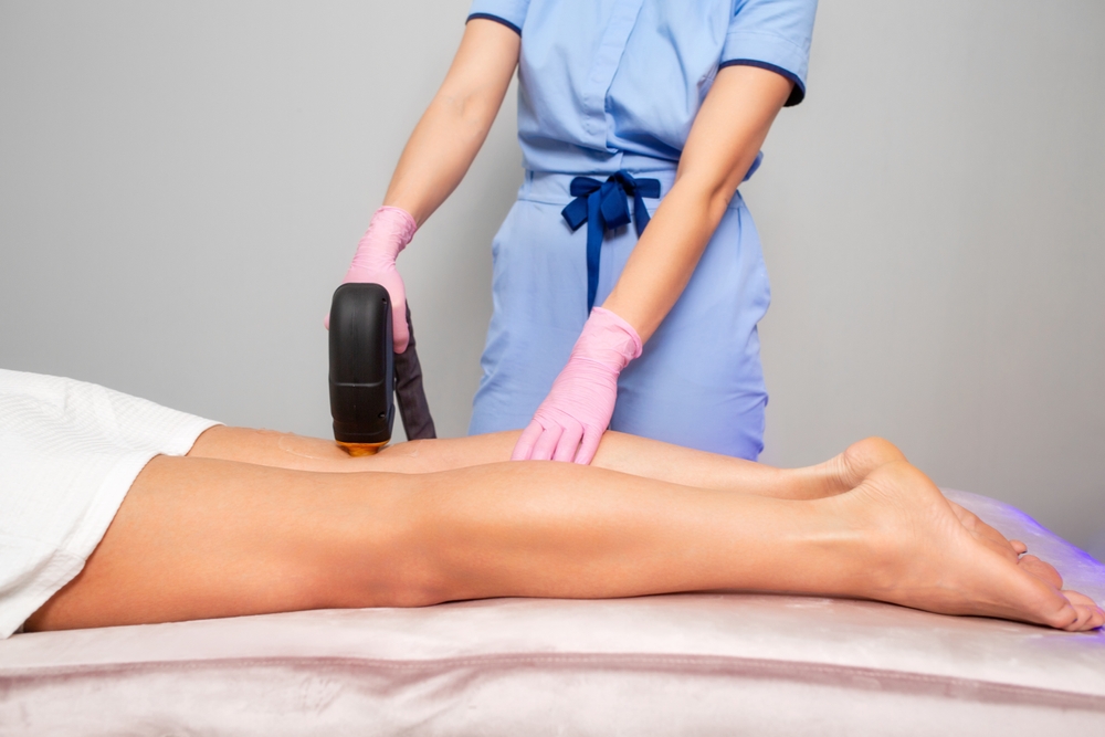 Beautician,Does,Laser,Hair,Removal,On,Woman's,Legs,With,Varicose Traitement des varicosités au laser sur les jambes d'une patiente