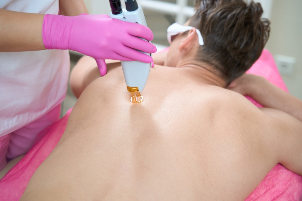 Man,Is,Visiting,Cosmetologist,For,Back,Epilation Épilation au laser du dos d'une homme