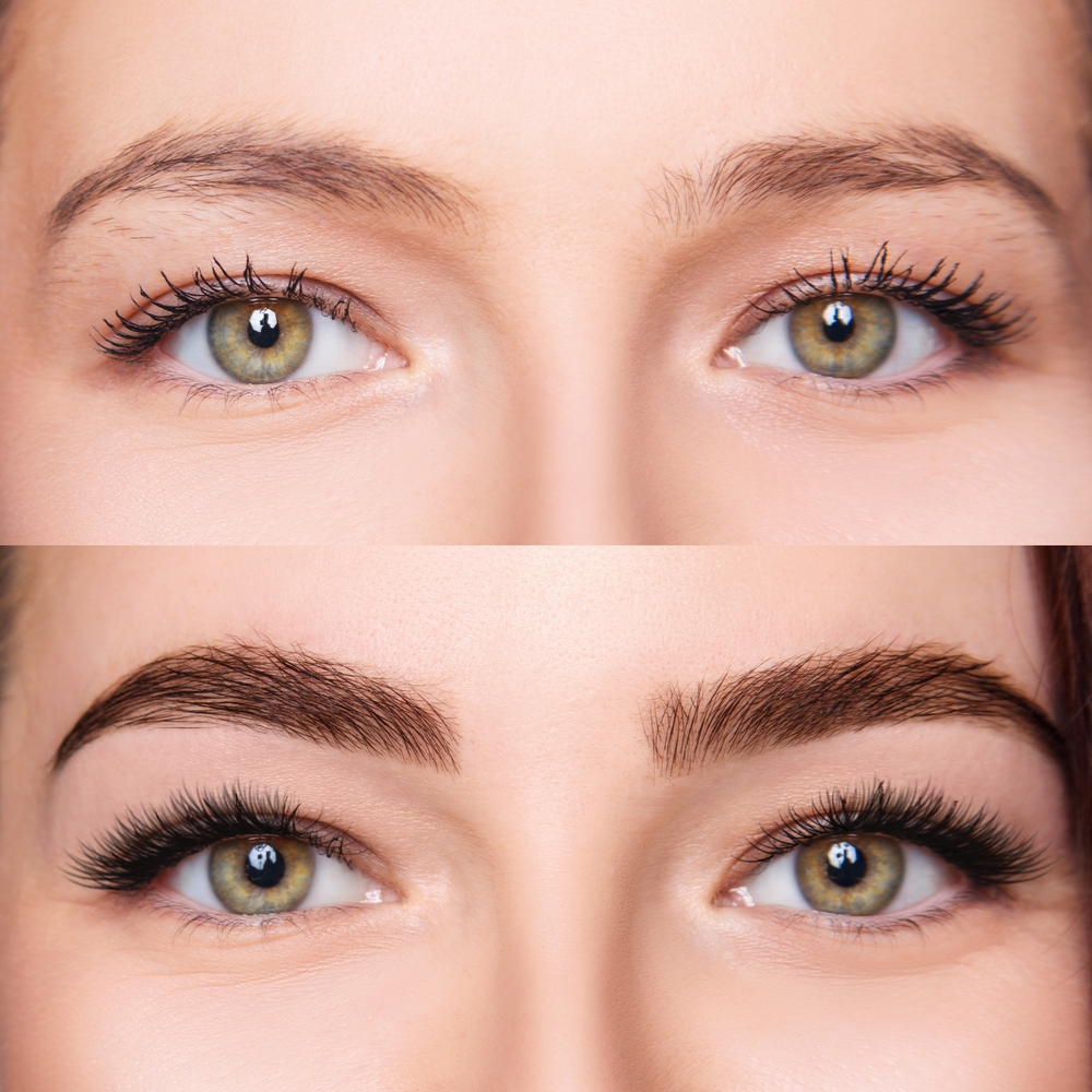 Female,Eyebrows,Before,And,After,Brows,Correction.,Close-up. Résultats de la lamination des sourcils en clinique esthétique