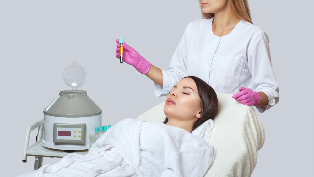 Cosmetologist,Does,Prp,Therapy,On,The,Face,And,Scalp,Of Une esthéticienne tient une fiole avec du sang et des plaquettes (PRP) séparés par la centrifugeuse