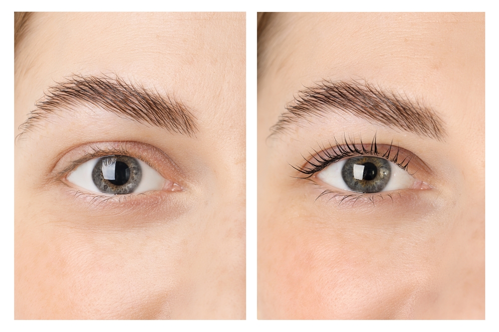 Résultats de la lamination des sourcils en clinique esthétique Résultats de la lamination des sourcils en clinique esthétique