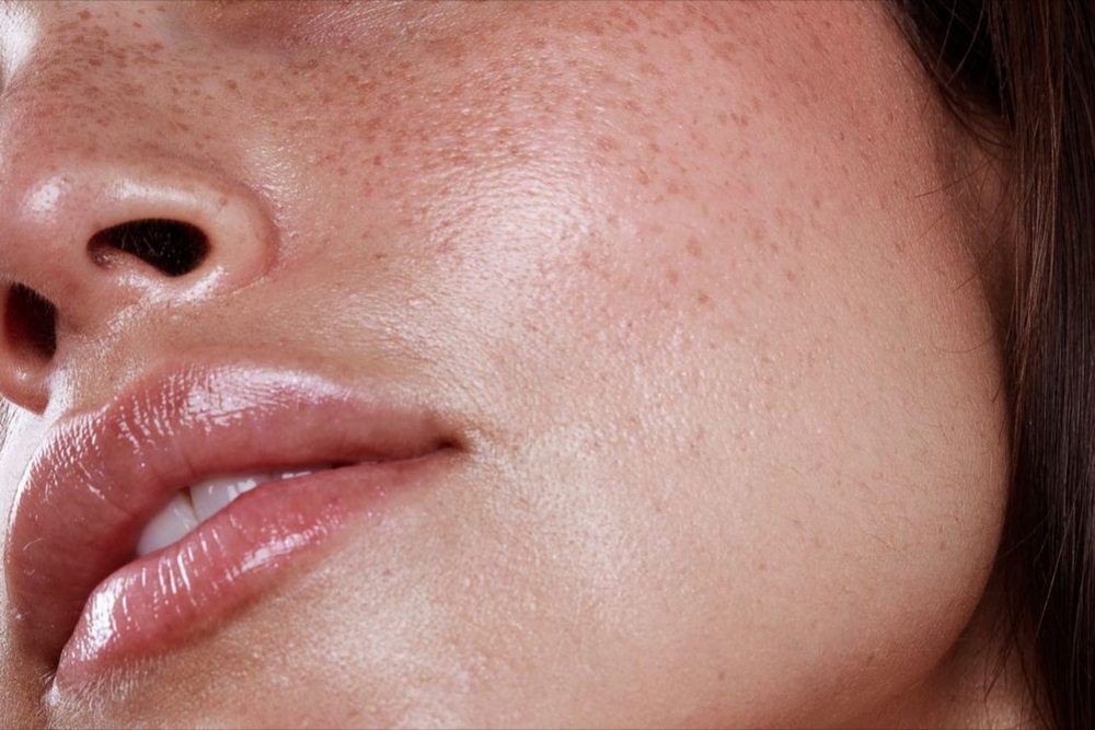 Beautiful,Young,Woman,In,Her,Thirties,,Brunette,With,Makeup,,Glowing Gros plan du visage d'une femme pour voir les effets du laser non fractionnel